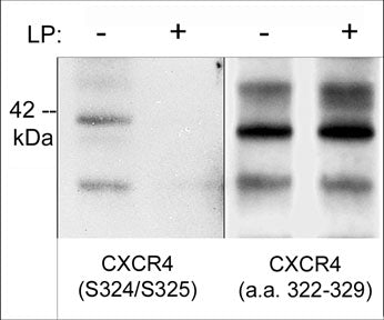 Western blot analysis of human Jurkat cells treated with 100 nM calyculin A for 30 min.  then the blots were untreated (-) or treated (+) with lambda phosphatase. The blots were probed with rabbit polyclonal anti-CXCR4 (Ser-324/Ser-325) (left panel), or anti-CXCR4 (a.a. 328-338) (right panel).