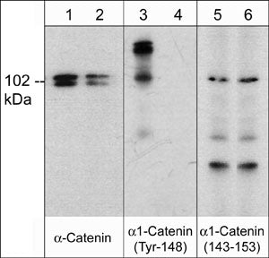 Western blot analysis of rat PC12 cells treated with pervanadate (1 mM) for 30 min (lanes 1, 3, & 5) then the blot was treated with alkaline phosphatase (lanes 2, 4, & 6). The blot was probed with anti-α-Catenin monoclonal (lanes 1 & 2), anti-α1-Catenin (Tyr-148) phospho-specific (lanes 3 & 4), or anti-α1-Catenin (a.a. 143-153) (lanes 5 & 6).