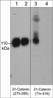 Western blot analysis of δ1-Catenin phosphorylation in A431 cells stimulated with calyculin A (100 nM) for 30 min. (lanes 1 & 3) then the blot was treated with lambda phosphatase (lanes 2 & 4). The blots were probed with either mouse monoclonal anti-δ1-Catenin (a.a. 275-285) (lanes 1 & 2) or rabbit polyclonal anti-δ1-Catenin (Thr-916) (lanes 3 & 4).