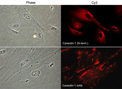 Immunocytochemical labeling of caveolin-1 in paraformaldehyde-fixed and NP-40-permeabilized rabbit spleen fibroblasts. The cells were labeled with rabbit polyclonal Caveolin-1 (N-terminal region) and mouse monoclonal Caveolin-1 antibodies, and detected using appropriate secondary antibodies conjugated to Cy3. Phase contrast images (left) and  immunofluorescent images (right).