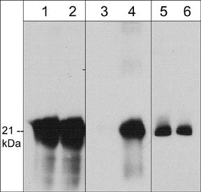 Western blot image of human A431 cells unstimulated (lanes 1, 3, & 5) or stimulated with pervanadate (1 mM) for 30 min (lanes 2, 4, & 6). The blots were probed with rabbit polyclonal caveolin-1 (N-term.) (lanes 1 & 2), mouse monoclonal caveolin-1 (Tyr-14) (lanes 3 & 4) or mouse monoclonal caveolin-1 (lanes 5 & 6).