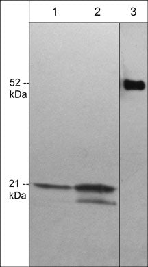 Immunocytochemical labeling in paraformaldehyde fixed and NP-40 permeabilized rat A7r5 cells. The cells were labeled with mouse monoclonal Anti-Cdc42 (CM4301) in the absence (Left) or presence of full length Cdc42 recombinant protein (Right), then the antibody was detected using Goat anti-Mouse secondary antibody conjugated to DyLight® 594.