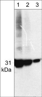 Western blot analysis of human HeLa cells. The blot was probed with anti-Cdk5 (CM2361) antibody at 1:250 (lane 1), 1:1000 (lane 2), and 1:4000.(lane 3).