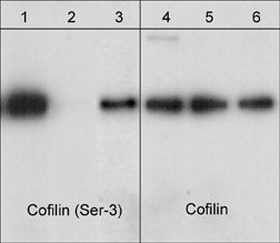Western blot of cofilin in jurkat cells. The blots were untreated (lanes 1 & 4) or treated (lanes 2, 3, 5 & 6) with lambda phosphatase. In lanes 3 & 6, the phosphatase was inhibited with phospho-Cofilin 1 (Ser-3) peptide. The blots were probed with anti-Cofilin 1 (Ser-3) phospho-specific (lanes 1-3) or anti-Cofilin 1 (N-terminus) (lanes 4-6).