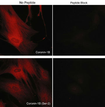 Immunocytochemical labeling of coronin-1B in rabbit spleen fibroblasts treated with Calyculin A. The cells were labeled with rabbit polyclonal Coronin-1B (C-terminus) and Coronin-1B (Ser-2) antibodies, then detected using appropriate secondary antibodies conjugated to Cy3. The antibodies were used in the absence (left) or presence (right) of their respective blocking peptide (CX2585 or CX2625).