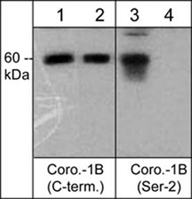 Western blot analysis of human A431 cells  treated with Calyculin A (100 nM) for 30 min (lanes 1 & 3) before treatment with lambda phosphatase (lanes 2 & 4). The blots were probed with anti-Coronin-1B (C-terminal region) (lanes 1 & 2) and anti-Coronin-1B (Ser-2) (lanes 3 & 4).