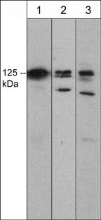 Immunocytochemical labeling of DAAM1 in aldehyde-fixed and NP-40-permeabilized A431 cells. The cells were labeled with mouse monoclonal DAAM1 (N-terminal region) antibody, then the antibody was detected using appropriate secondary antibody conjugated to DyLight® 594. The corresponding phase image is shown to the right.