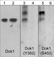 Western blot image of Jurkat cells stimulated with calyculin A (100 nM, 30 min) (lanes 1-6) followed by lambda phosphatase (lanes 2 & 6) or alkaline phosphatase (lane 4) treatment. The blots were probed with anti-Dok1 (lanes 1 & 2), anti-Dok1 (Tyr-362) (lanes 3 & 4), and anti-Dok1 (Ser-450) (lanes 5 & 6).