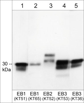 Western blot of EB proteins in mouse brain (lanes 1-5). The blot was probed with rat monoclonals EM5041 anti-EB1 (lane 1), EM5061 anti-EB1/2/3 (lane 2), EM5081 anti-EB2 (lane 3), EM5101 anti-EB3 (lane 4), and EM5091 anti-EB3 (lane 5). Then the antibodies were detected using goat anti-Rat IgG Light Chain specific:HRP (RS3121).