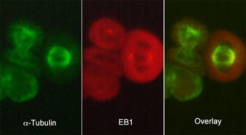 Immunocytochemical labeling of EB1 in paraformaldehyde-fixed and NP40-permeabilized A431 cells. The cells were dual labeled with mouse monoclonal anti-α-Tubulin (TM4111) (left)  and rat monoclonal anti-EB1 (EM5041) (middle). The antibodies were detected using either goat anti-mouse:DyLight® 488 (MS3011) or goat anti-Rat:DyLight® 594 (RS3111).
