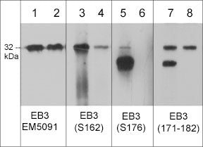 Western blot analysis of adult mouse brain untreated (lanes 1, 3, 5, & 7) or treated with lambda phosphatase (lanes 2, 4, 6, & 8). The blots were probed with rat monoclonal anti-EB3 (EM5091) (lanes 1 & 2), and rabbit polyclonals anti-EB3 (Ser-162) (lanes 3 & 4), anti-EB3 (Ser-176) (lanes 5 & 6), and anti-EB3 (a.a. 171-182) (lanes 7 & 8).