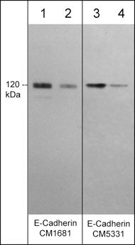 Western blot image of human A431 cells  (lanes 1-4). The blots were probed with mouse monoclonals anti-E-Cadherin (Cytoplasmic) at 1:1000 (lane 1) and 1:4000 (lane 2) and anti-E-Cadherin (C-terminal fragment) at 1:250 (lane 3) and 1:1000 (lane 4).
