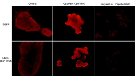 Immunocytochemical labeling in A431 cells untreated or treated with Calyculin A (50 nM) for 15 min. Cells were labeled with anti-EGFR (a.a. 961-972) or anti-EGFR (Ser-1142) antibodies. The specificity of labeling was demonstrated for each antibody by blocking the signals with their respective blocking peptides, EGFR (a.a. 961-972) (EX1875) and phospho-EGFR (Ser-1142) (EX1935).