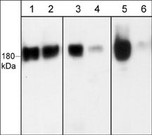 Western blot image of human A431 cells treated with Calyculin A (100 nM) for 30 min. Blot lanes were untreated (lanes 1, 3, & 5) or treated with lambda phosphatase (lanes 2, 4, & 6) then were probed with anti-EGFR (a.a. 961-972) (lanes 1 & 2), anti-EGFR (Ser-967) (lanes 3 & 4), and anti-EGFR (Ser-1142) (lanes 5 & 6).