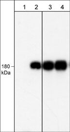 Western blot image of human A431 cells untreated (lanes 1 & 3) or treated with EGF (100 ng/ml) for 5 min. The blot was probed with anti-EGFR (Tyr-1101) monoclonal antibody (lanes 1 & 2) or anti-EGFR (Cytoplasmic)  monoclonal antibody (lanes 3 & 4).