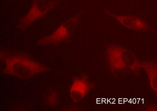 Immunocytochemical labeling of ERK2 in aldehyde-fixed and NP-40 permeabilized human NCI-H1915 lung carcinoma cells. The cells were labeled with rabbit polyclonal anti-ERK2 (EP4071) antibody. The antibody was detected using appropriate secondary antibody conjugated to DyLight® 594.