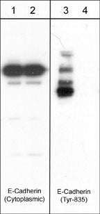 Western blot image of human A431 cells  treated with pervanadate (1 mM) for 30 min (lanes 1 & 3) then treated with akaline phosphatase (lanes 2 & 4). Blots were probed with anti-E-Cadherin (Cytoplasmic) and anti-N-Cadherin (Tyr-860)/E-Cadherin (Tyr-835) conserved site.