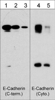 Western blot image of human A431 cells that were probed with rabbit polyclonal anti-E-Cadherin (a.a. 774-786) at 1:250 (lane 1), 1:1000 (lane 2), and 1:4000 (lane 3) or mouse monoclonal anti-E-cadherin (Cytoplasmic) at 1:250 (lane 4) and 1:1000 (lane 5).