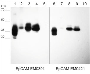 Western blot of native lysates including human EpCAM extracellular region (lane 1 & 6), MCF7 breast carcinoma (lane 2 & 7), A431 skin adenocarcinoma (lane 3 & 8), NCI-H1915 lung carcinoma (lane 4 & 9), and NCI-H446 lung carcinoma (lane 5 & 10). The blot was probed with mouse monoclonal anti-EpCAM (EM0391) (lanes 1-5) and mouse monoclonal anti-EpCAM (EM0421) (lanes 6-10) at 1:1000 each.