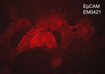 Immunocytochemical labeling of EpCAM in aldehyde fixed human NCI-H1915 lung carcinoma cells. The cells were labeled with mouse monoclonal anti-EpCAM (EM0421). The antibody was detected using goat anti-mouse Ig:DyLight® 594.