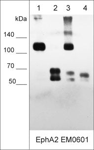 Western blot of human MDA-MB-231 breast carcinoma (lane 1), A431 epidermoid carcinoma (lane 2), NCI-H2052 epithelioid mesothelioma (lane 3), and A549 lung carcinoma (lane 4). The blot was probed with mouse monoclonal anti-EphA2 (EM0601) at 1:500.
