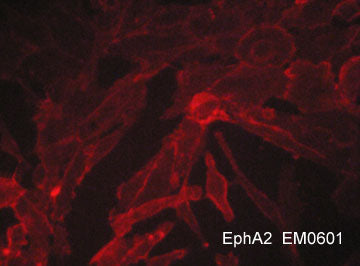 Immunocytochemical labeling of EphA2 in aldehyde fixed human MDA-MB-231 breast carcinoma cells. The cells were labeled with mouse monoclonal anti-EphA2 (EM0601). The antibody was detected using goat anti-mouse DyLight® 594.