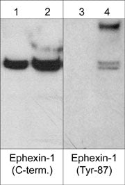 Western blot analysis of human A431 cells untreated (lanes 1 & 3) or treated with pervanadate (1 mM) for 30 min. (lanes 2 & 4). The blot was probed with anti-Ephexin-1 (C-terminal region) (lanes 1 & 2) and anti-Ephexin-1 (Tyr-87) (lanes 3 & 4).