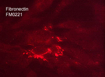 Immunocytochemical labeling of fibronectin in paraformaldehyde fixed human MeWo cells. The cells were labeled with mouse monoclonal anti-fibronectin (clone M022). The antibody was detected using goat anti-mouse Ig DyLight® 594.