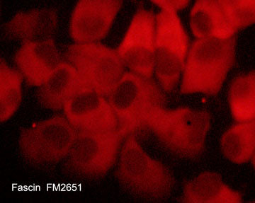 Immunocytochemical labeling of Fascin in aldehyde fixed and NP-40 permeabilized human NCI-H1915 lung carcinoma cells. The cells were labeled with mouse monoclonal anti-Fascin (FM2651). The antibody was detected using goat anti-mouse DyLight® 594.