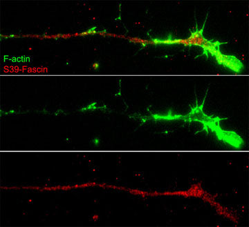 Immunocytochemical labeling of fascin phosphorylation relative to F-actin in chick E9 DRG neurons. The cells were labeled with rabbit polyclonal Fascin (Ser-39) antibody, then detected using appropriate secondary antibody (Red). Fascin (Ser-39) labeling is compared (Top) to F-actin staining (Green). (Image provided by Dr. Gianluca Gallo at Drexel University).