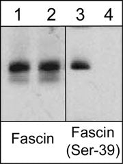 Western blot analysis of human HeLa cells  treated with Calyculin A (100 nM) for 30 min (lanes 1 & 3) before treatment with lambda phosphatase (lanes 2 & 4). The blots were probed with anti-Fascin (clone 55K2) (lanes 1 & 2) and anti-Fascin (Ser-39) (lanes 3 & 4).