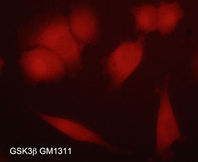 Immunocytochemical labeling of GSK3β in aldehyde-fixed and NP-40 permeabilized human NCI-H1915 lung carcinoma cells. The cells were labeled with mouse monoclonal anti-GSK3β (GM1311) antibody. The antibody was detected using appropriate secondary antibody conjugated to DyLight® 594.