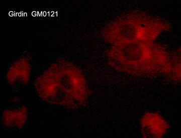Immunocytochemical labeling of Girdin in aldehyde fixed and NP-40 permeabilized human NCI-H1915 lung carcinoma cells. The cells
were labeled with mouse monoclonal anti-Girdin (GM0121). The antibody was detected using goat anti-mouse DyLight® 594.