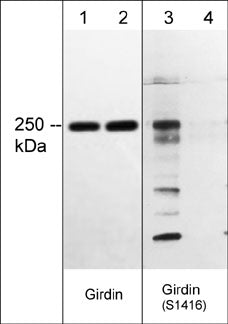 Western blot image of human A431 cell lysates treated with Calyculin A (lanes 1-4). The blot was treated with lambda phosphatase to dephosphorylate Girdin phosphosites (lanes 2 & 4). The blot was probed with mouse  monoclonal anti-Girdin (lanes 1 & 2) or rabbit polyclonal anti-Girdin (Ser-1416), phospho-specific (lanes 3 & 4).
