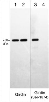 Western blot image of human A431 cell lysates treated with Calyculin A (lanes 1-4). The blot was treated with lambda phosphatase to dephosphorylate Girdin phosphosites (lanes 2 & 4). The blot was probed with mouse  monoclonal anti-Girdin (lanes 1 & 2)  or rabbit polyclonal anti-Girdin (Ser-1674), phospho-specific (lanes 3 & 4).