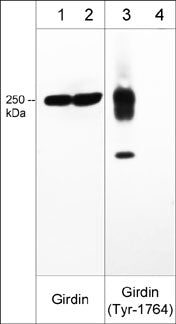 Western blot image of human A431 cell lysates treated with pervanadate (lanes 1-4). The blot was treated with alkaline phosphatase to dephosphorylate Girdin phosphosites (lanes 2 & 4). The blot was probed with mouse  monoclonal anti-Girdin (lanes 1 & 2)  or rabbit polyclonal anti-Girdin (Tyr-1764), phospho-specific (lanes 3 & 4).
