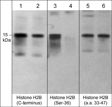 Western blot analysis of human Jurkat cells treated with calyculin A (100 nM) for 30 min. (lanes 1, 3, & 5) then the blots were treated with lambda phosphatase (lanes 2, 4, & 6). The blots were probed with anti-Histone H2B (C-terminus) (lanes 1 & 2), anti-Histone H2B (Ser-36) (lanes 3 & 4), and anti-Histone H2B (a.a. 33-47) (lanes 5 & 6).