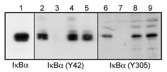 Western blot analysis of A431 cells treated with pervanadate (1 mM) for 30 min. Blots were probed with anti-IκBα (lane 1), anti-IκBα (Tyr-42) (IP1031; lanes 2-5), or anti-IκBα (Tyr-305) (IP1041; lanes 6-9). In some lanes, the antibodies were used in the absence (lane 2 & 6) or presence of IκBα (Tyr-42) (lane 3 & 8) or IκBα (Tyr-305) (lane 4 & 7) blocking peptides, or BSA conjugated to phospho-tyrosine (lane 5 & 9).