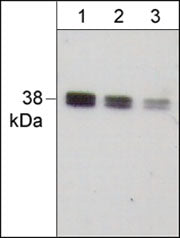 Western blot image of human A431. The Blots were probed with anti-IκBα (C-term.) polyclonal antibody at a dilution of 1:500 (lane 1), 1:1000 (lane 2), and 1:2000 (lane 3).