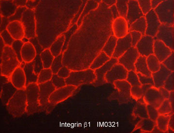 Immunocytochemical labeling of Integrin β1 in paraformaldehyde fixed human A431 cells. The cells were labeled with mouse monoclonal anti-Integrin β1 (IM0321). The antibody was detected using goat anti-mouse Ig DyLight® 594.