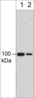 Western blot analysis of human umbilical vein endothelial cells (HUVEC). The blots were probed with mouse monoclonal anti-integrin β3 (IM5811) at 1:250 (lane 1) and 1:1000 (lane 2).