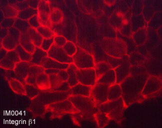 Immunocytochemical labeling of Integrin β1 in paraformaldehyde fixed human A431 cells. The cells were labeled with mouse monoclonal anti-Integrin β1 (clone M004). The antibody was detected using goat anti-mouse DyLight® 594.