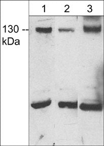 Western blot showing JMY expression in rat PC12 cells (lane 1), human Jurkat cells (lane 2), and adult mouse heart (lane 3). The blots were probed with anti-JMY (C-terminal region) rabbit polyclonal antibody at 1:500.