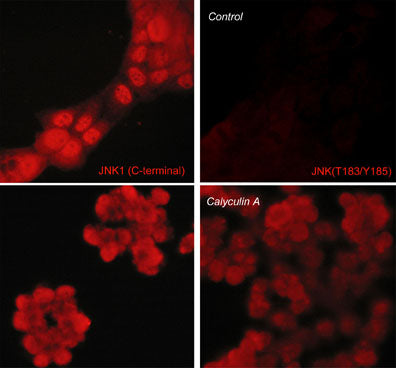 Immunocytochemical labeling of JNK in control (Top row) or calyculin A-treated A431 cells (Bottom row). The cells were labeled with mouse monoclonal JNK (C-terminal region) (Left) or mouse monoclonal JNK (Thr-183/Tyr-185) (Right). The antibodies were detected using goat anti-mouse DyLight® 594.