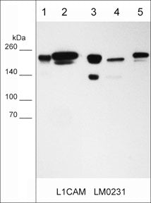 Immunocytochemical labeling of L1CAM in paraformaldehyde fixed human MeWo cells. The cells were labeled with mouse monoclonal anti-L1CAM (LM0231). The antibody was detected using goat anti-mouse Ig DyLight® 594.