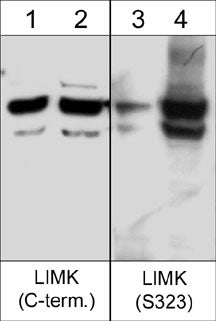 Western blot image of human A431 cells untreated (lanes 1 & 3) or treated (lanes 2 & 4)with calyculin A (100 nM for 30 min) . The blots were probed with anti-LIMK1 (C-terminus) (lanes 1 & 2) or anti-LIMK1 (Ser-323) (lanes 3 & 4).
