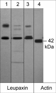 Western blot analysis of leupaxin in human PC-3, rat A7r5, and human A431 cells. The blot was probed with anti-Leupaxin (N-terminal region) at 1:1000 (Lanes 1-3). Anti-Actin molecular weight standard is shown in lane 4.
