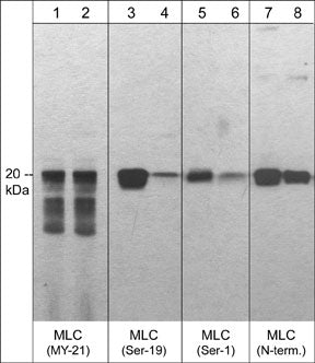Western blot analysis of C2C12 cells untreated (lanes 1, 3, 5, & 7) or treated with Lambda phosphatase (lanes 2, 4, 6, & 8). The blots were probed with monoclonal anti-MLC20 (clone MY-21) (lanes 1 & 2), polyclonal anti-MLC (Ser-19) phosho-specific (lanes 3 & 4), anti-MLC (Ser-1) phosho-specific (lanes 5 & 6), or anti-MLC (a.a. 11-22) (lanes 7 & 8) .