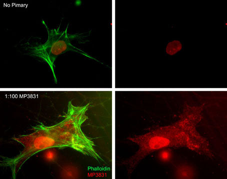 Immunocytochemical labeling of myosin IIA heavy chain phosphorylation relative to F-actin in chick fibroblasts. The cells were labeled with rabbit polyclonal Myosin IIA Heavy Chain (Ser-1943) antibody (MP3831), then detected using appropriate secondary antibody (Bottom, Red). This labeling is compared to F-actin staining (Bottom, Green) and to secondary only (Top). (Image provided by Dr. Gianluca Gallo at Drexel University).