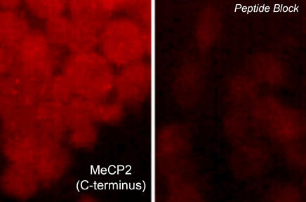 Immunocytochemical labeling of MeCP2 in rat PC12 cells differentiated with NGF. The cells were probed with MeCP2 (C-terminus) rabbit polyclonal antibody (MP4591) in the absence (left) or presence (right) of blocking peptide (MX4595). The antibody was detected using appropriate secondary antibody conjugated to DyLight® 594.